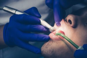 Tooth Nerve Pain Relief: Causes, Symptoms & Treatment Options | Dental Made Easy